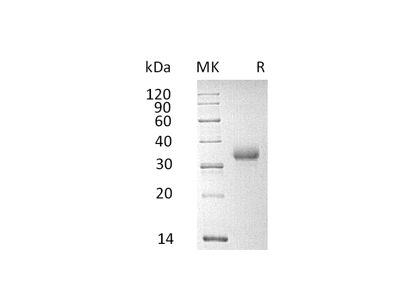 Recombinant Human CD2 (C-6His)