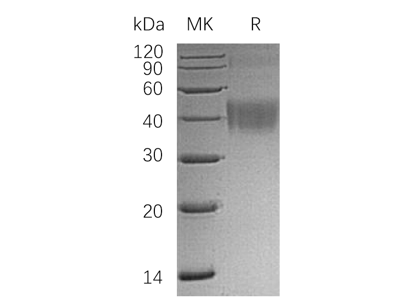 Recombinant Human CD200 (C-6His)