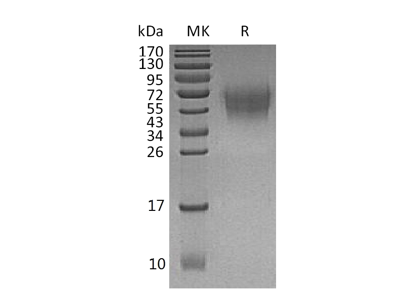 Recombinant Human DNAM-1 (C-6His)