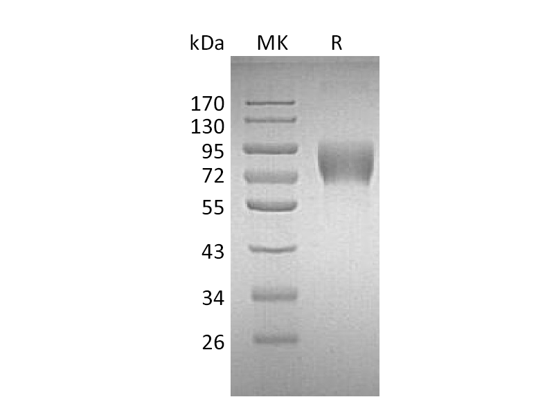 Recombinant Human DNAM-1 (C-Fc)