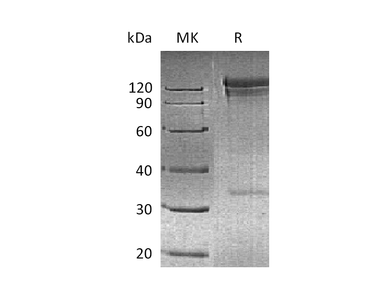 Recombinant Human CD26 (N-Fc)