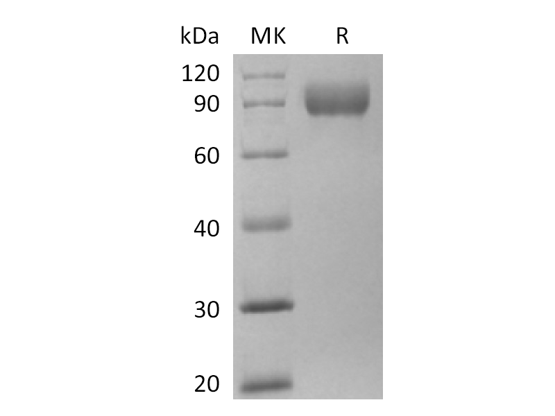 Recombinant Human TRAIL R3 (C-Fc-6His)