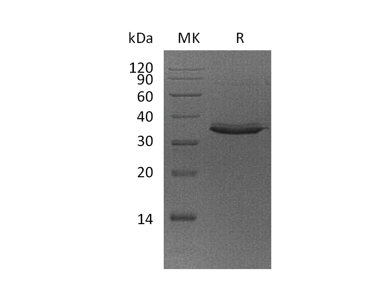 Recombinant Human TWEAK R (C-Fc)