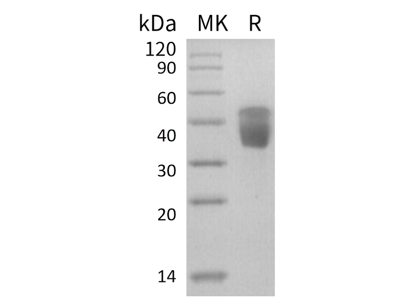 Recombinant Human CLEC10A (C-6His)
