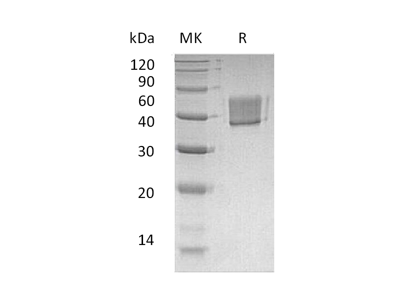 Recombinant Human FcRL1 (C-6His)