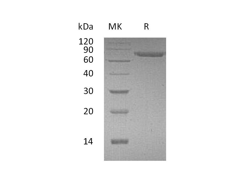 Recombinant Human CD316 (C-6His)