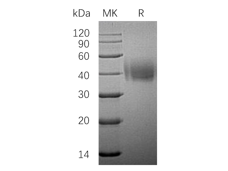 Recombinant Human SLAMF7 (C-6His)
