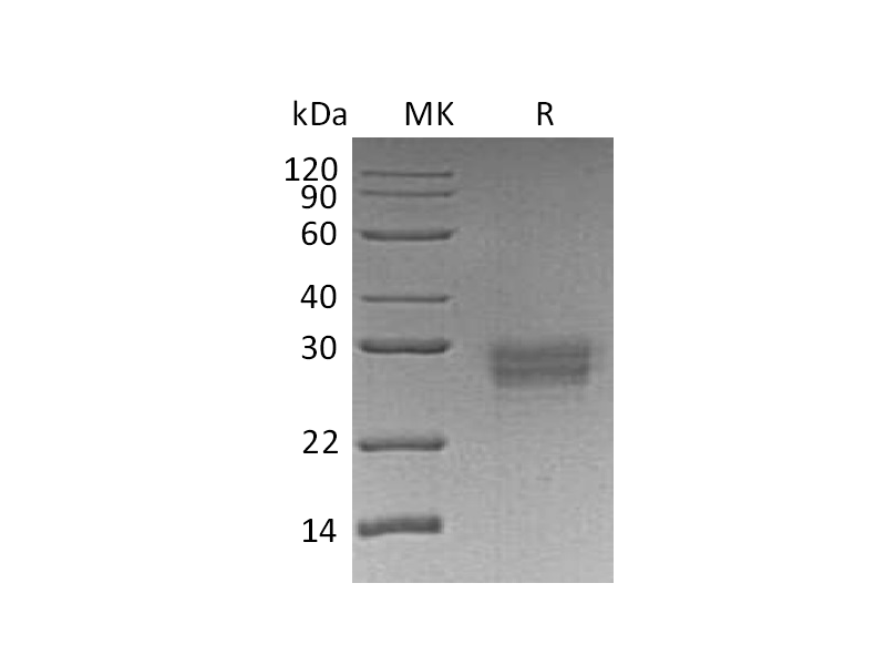 Recombinant Human CD32b (C-6His)