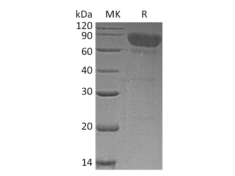 Recombinant Human TCblR (C-Fc)