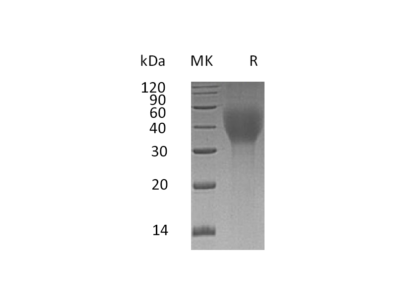 Recombinant Human TCblR (C-6His)