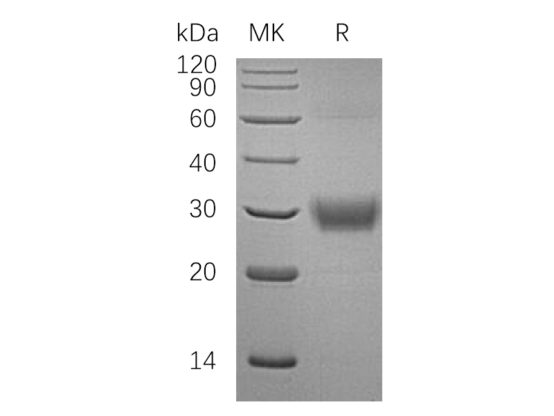 Recombinant Human CD32a (R167, C-6His)