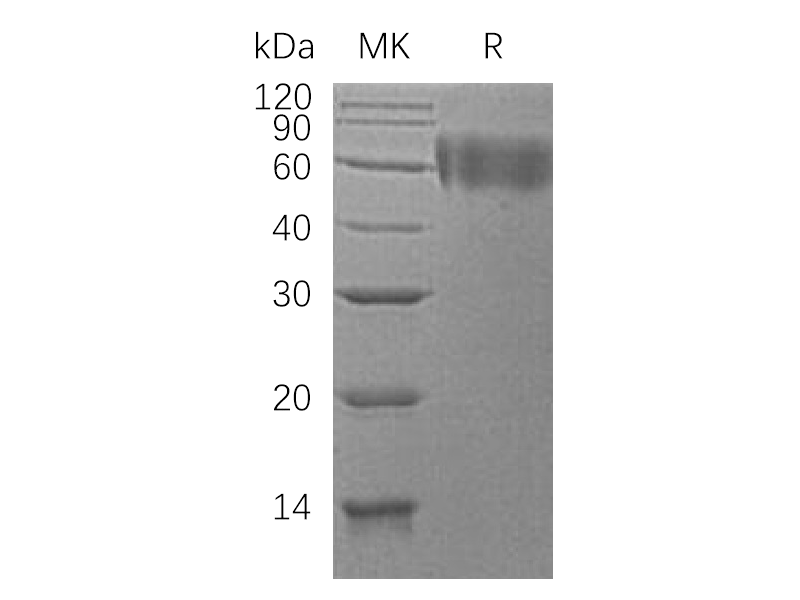 Recombinant Human DR6 (C-6His)