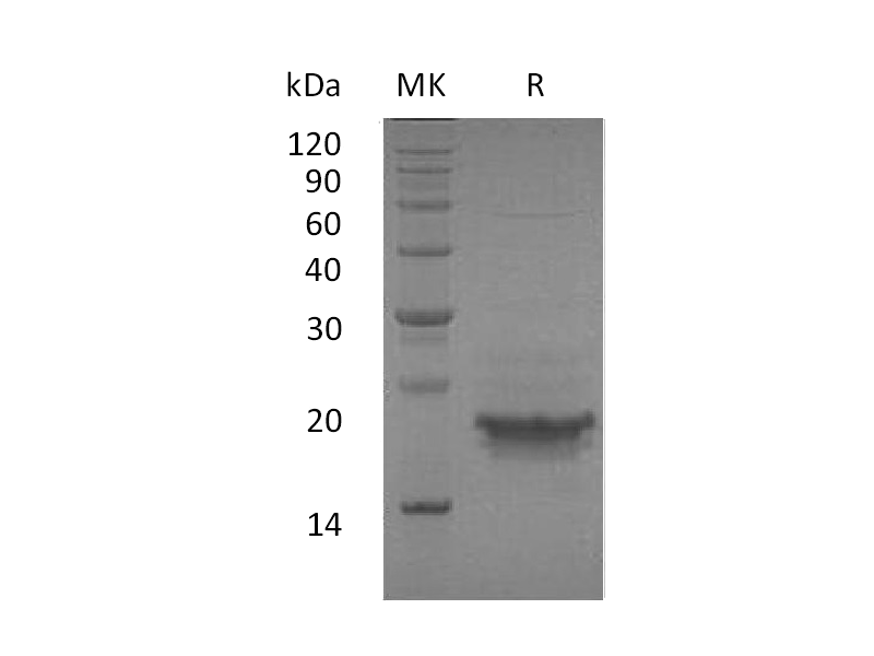 Recombinant Human CD3E (C-6His)