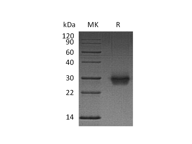 Recombinant Human CD40 (C-6His)