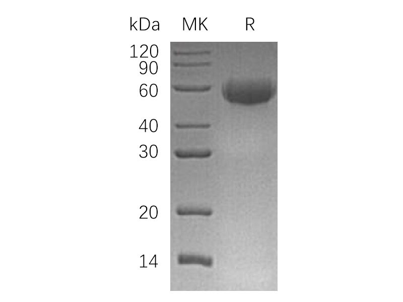 Recombinant Human CD46 (C-6His)