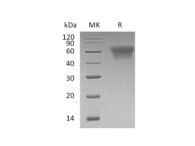 Recombinant Human CD55 (C-6His)