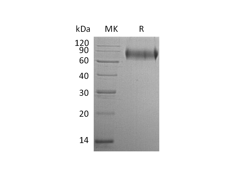 Recombinant Human E-selectin (C-6His)