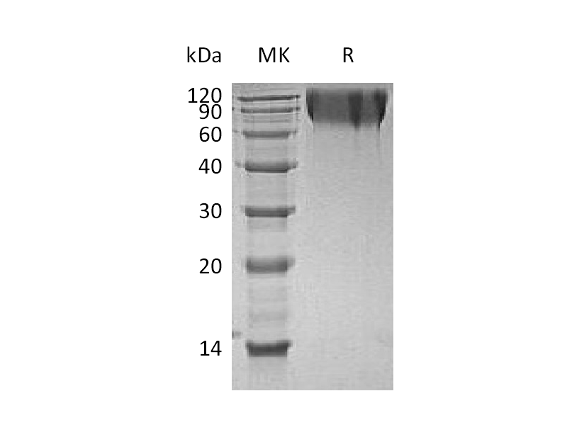 Recombinant Human CEACAM1 (C-6His)