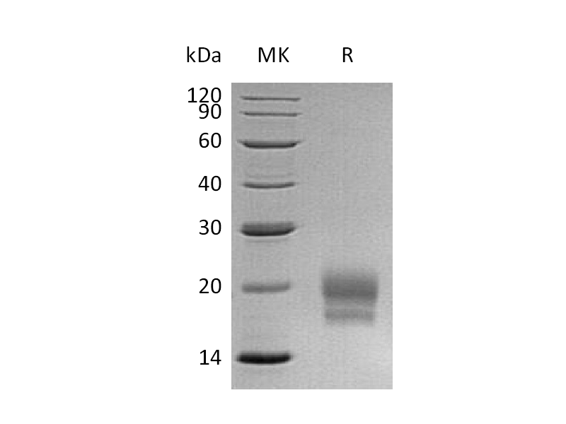 Recombinant Human CEACAM3 (C-6His)