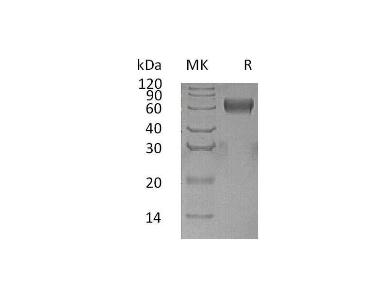 Recombinant Human PSG1 (C-6His)