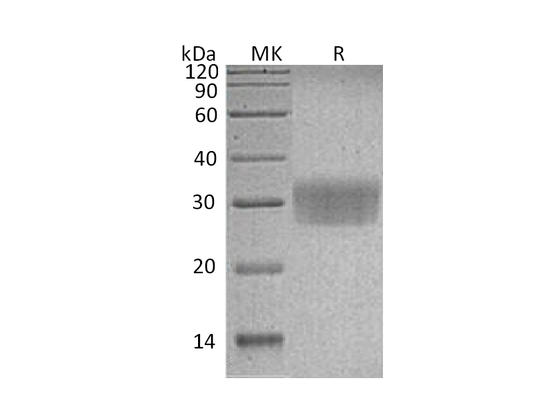 Recombinant Human CD7 (C-6His)