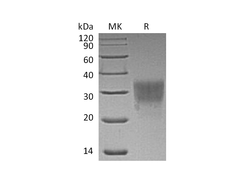 Recombinant Human CD79B (C-6His)