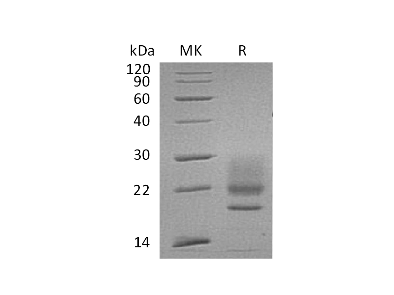 Recombinant Human CD83 (C-6His)