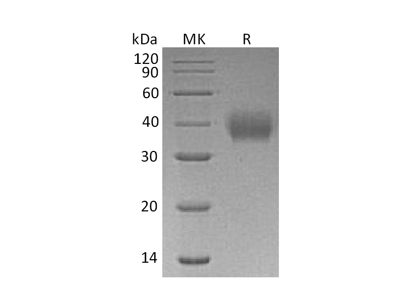 Recombinant Human FcAR (C-6His)