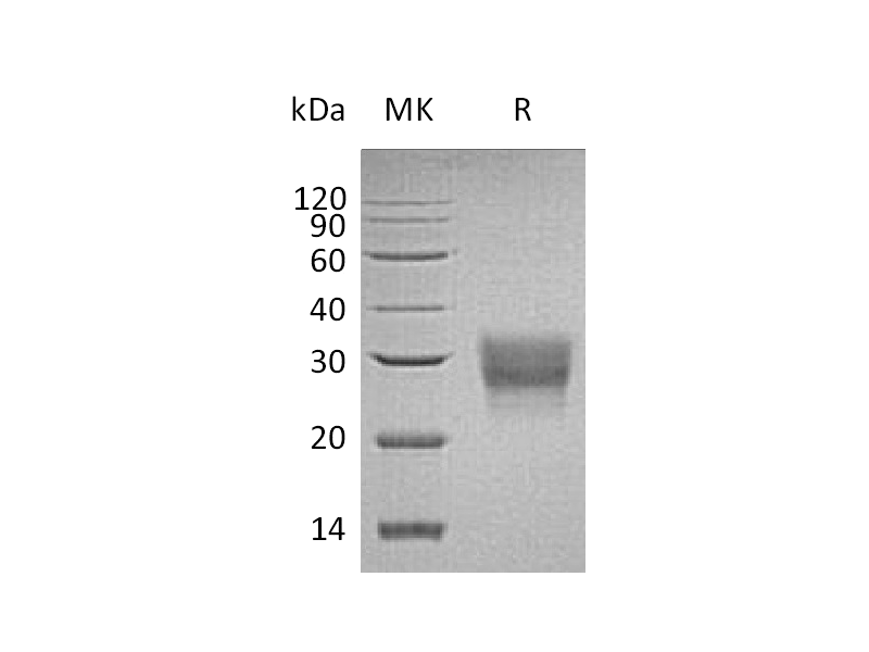 Recombinant Human CD8B (C-6His)