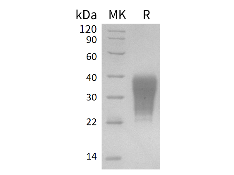Recombinant Human FAS (C-6His)