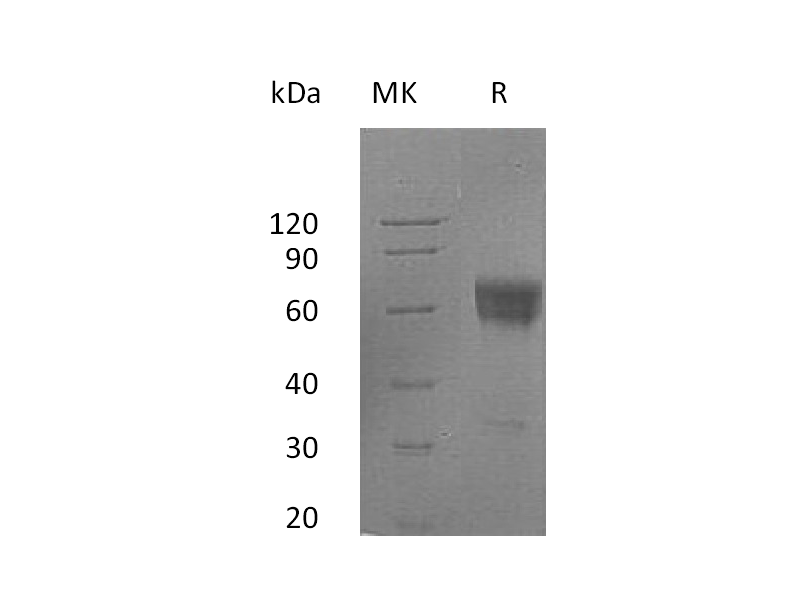 Recombinant Human FAS (C-Fc)