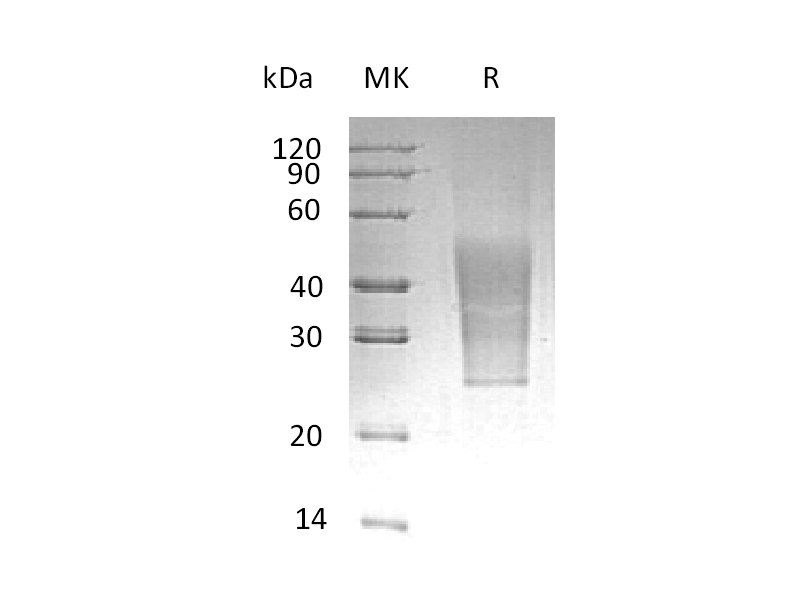 Recombinant Human CD99L2 (C-6His)