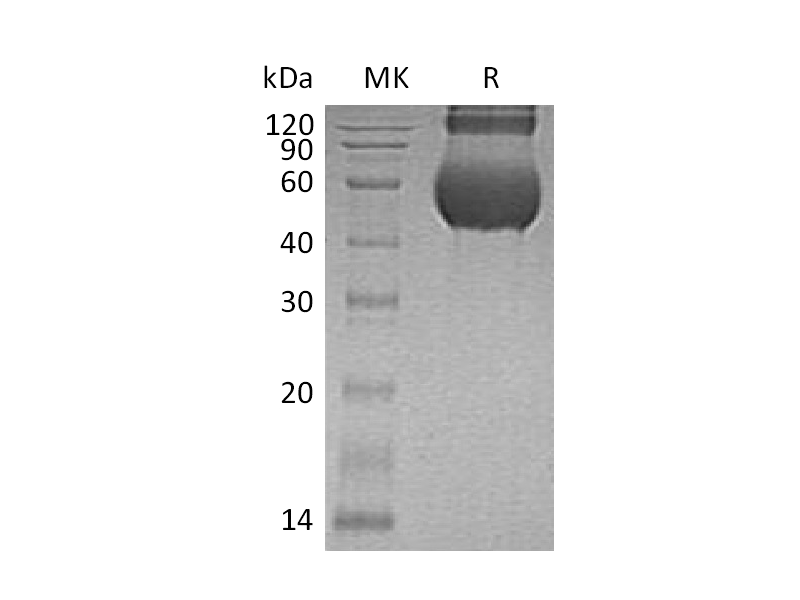 Recombinant Human CDCP1 (C-6His)