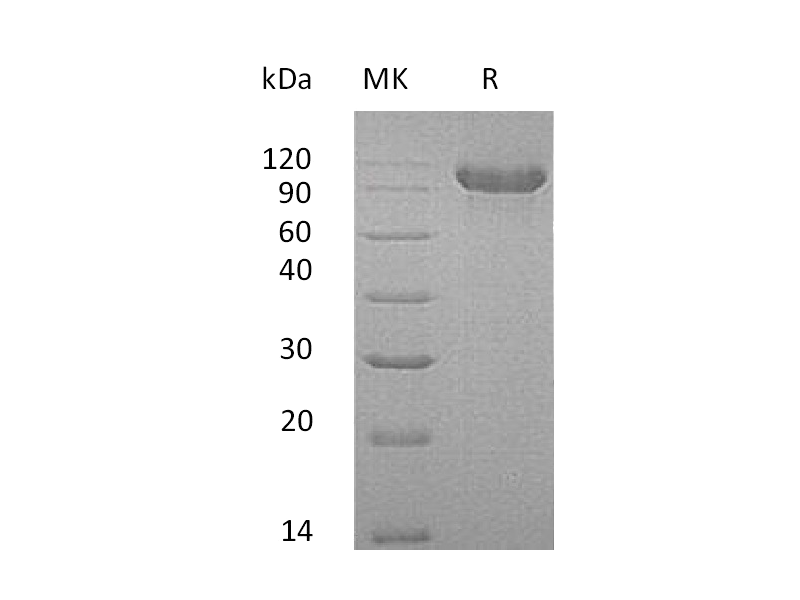 Recombinant Human CDH16 (C-6His)