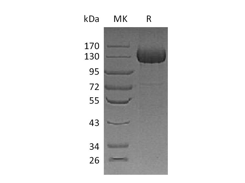 Recombinant Human CDO (C-6His)