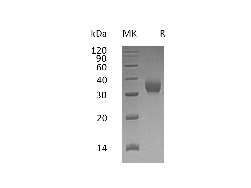 Recombinant Human CEACAM21 (C-6His)