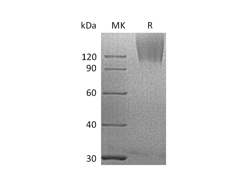 Recombinant Human CEACAM5 (C-6His)