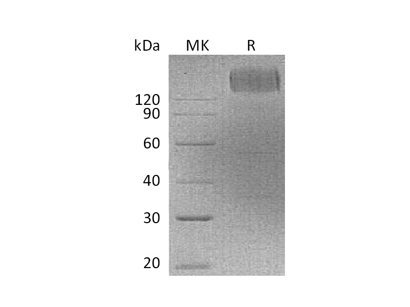 Recombinant Human CEACAM5 (C-Fc)