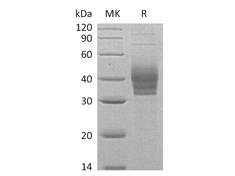 Recombinant Human Cerberus1 (C-6His)