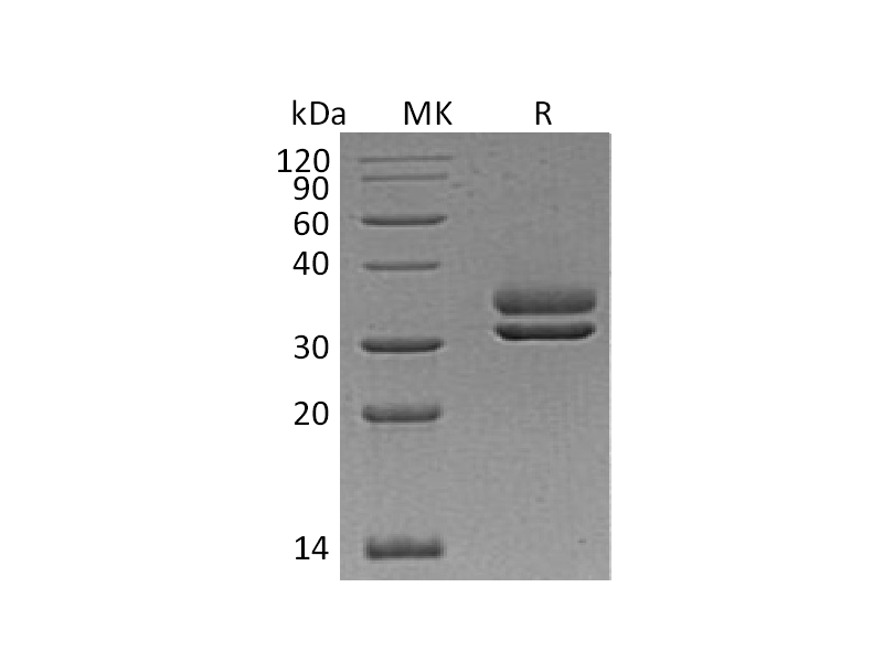 Recombinant Human CFHR2 (C-6His)