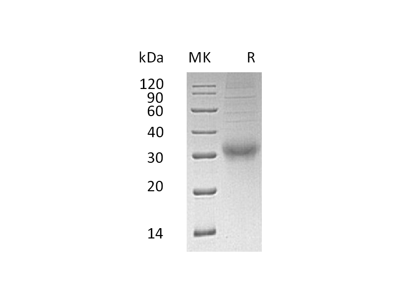 Recombinant Human CGB (C-6His)