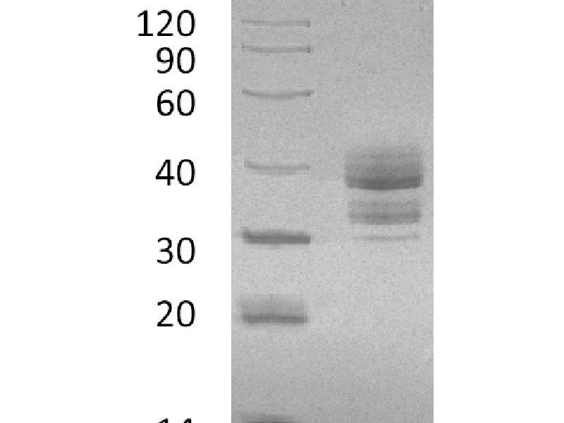 Recombinant Human CGREF1 (C-6His)