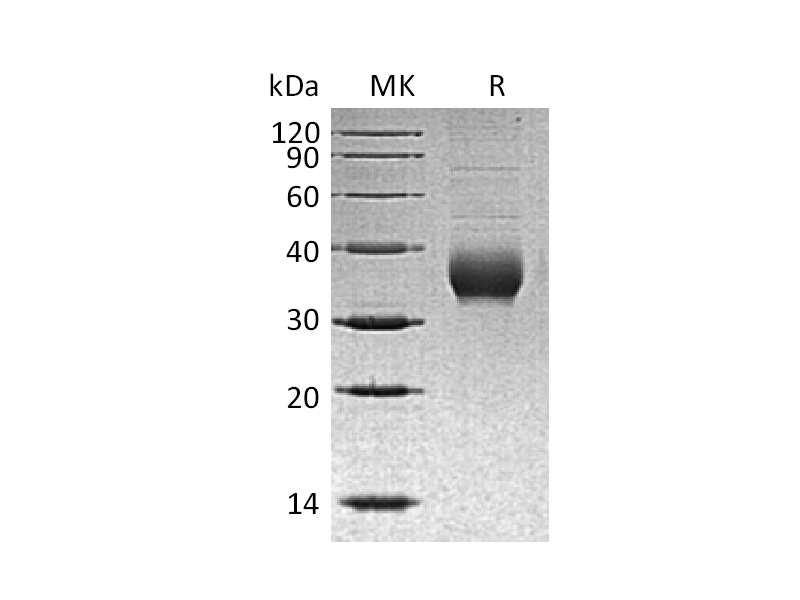 Recombinant Human CHRNB3 (C-6His)