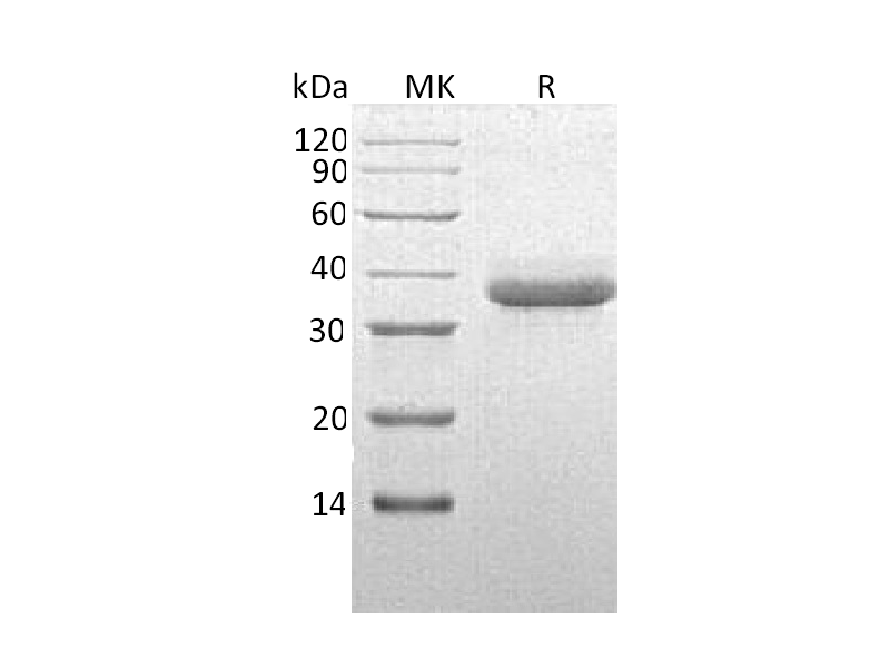 Recombinant Human CTRC (C-6His)