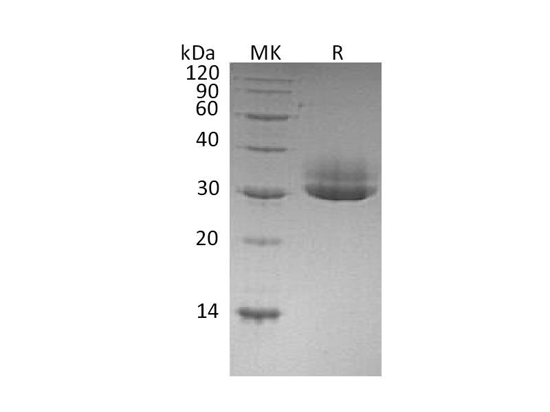 Recombinant Human CTRL (C-6His)