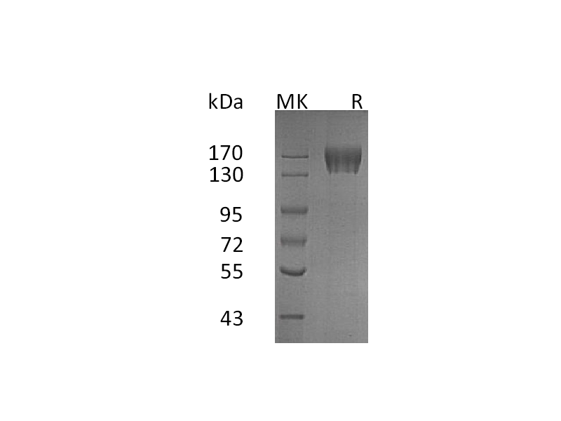 Recombinant Human CD117 (C-6His)