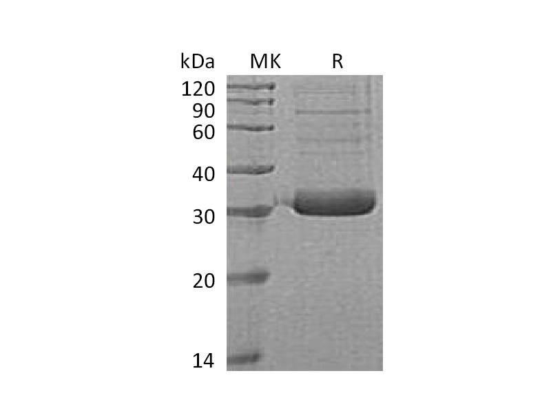 Recombinant Human Collectin-11 (C-6His)