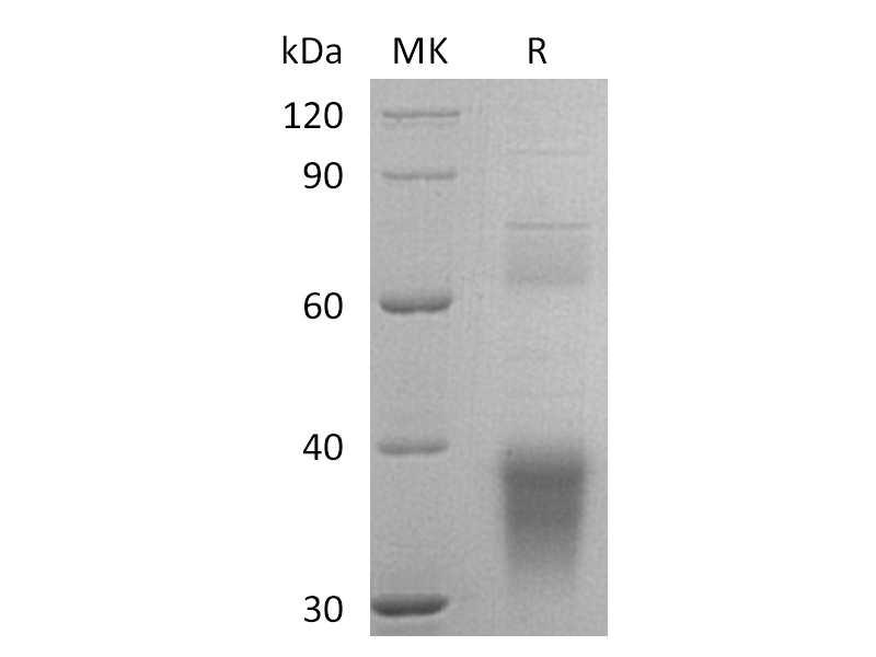 Recombinant Human Clusterin (C-6His)