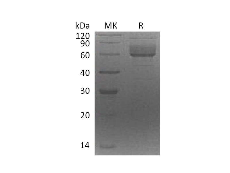 Recombinant Human CLUL1 (C-6His)