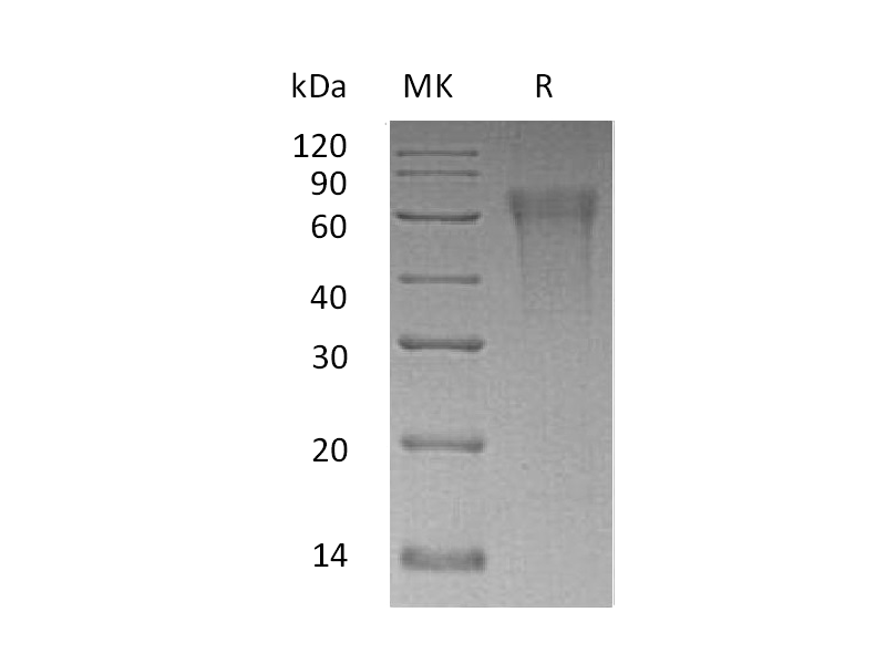 Recombinant Human CLM9 (C-6His)